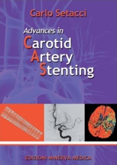 Advances in Carotid Artery Stenting